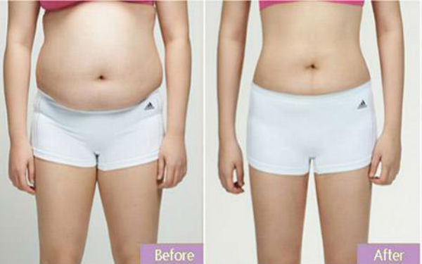 常德眼袋手術(shù)推薦排名TOP10！公私醫(yī)院詳細(xì)對(duì)比，看看你選對(duì)了沒(méi)有