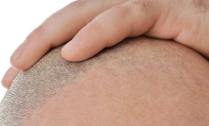 常州最好的激光祛斑醫(yī)院推薦：這些醫(yī)療機(jī)構(gòu)專業(yè)有力，效果明顯！快來看看！