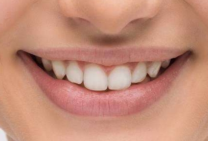 寧波五家信譽(yù)好、性價(jià)比高的植發(fā)醫(yī)院全景評(píng)測(cè)，匯總榜單前五強(qiáng)