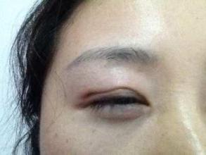 廣州隆鼻手術(shù)：挑選最好的醫(yī)生，口碑盤點！是否有你最滿意的專家？