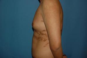 常州哪家眼部整形醫(yī)院效果好【推薦三家】