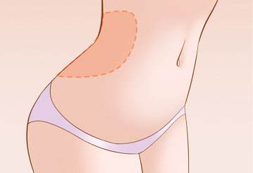 呼市哪家醫(yī)院最受歡迎？雙眼皮效果超過80%的用戶推薦！