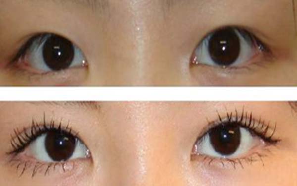 廣東疤痕修復(fù)?？漆t(yī)院榜單：8家被推薦的醫(yī)院表現(xiàn)出色