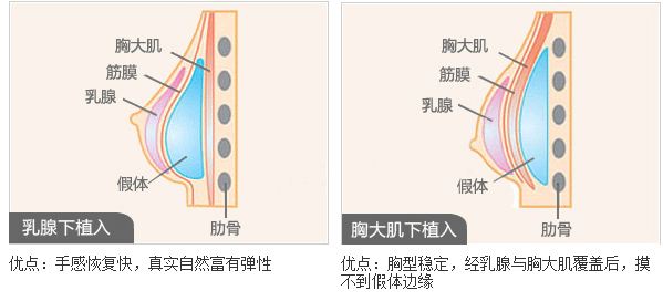 宜賓最佳雙眼皮整形醫(yī)院推薦！這七家美容院你絕不能錯(cuò)過(guò)