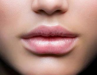 寧波愛(ài)貝芙填充面部醫(yī)生