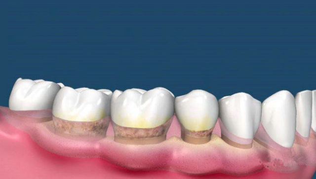 東莞瘦腹醫(yī)生