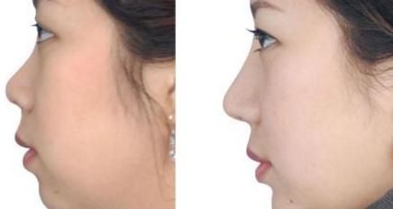 國(guó)內(nèi)十佳疤痕治療醫(yī)院評(píng)選結(jié)果曝光：公立醫(yī)院對(duì)私立醫(yī)院PK！