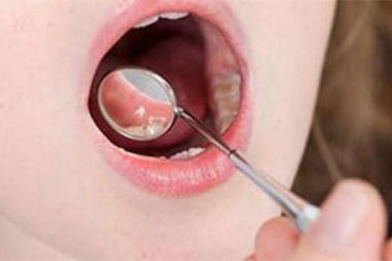 青島面部埋線提拉術(shù)醫(yī)生