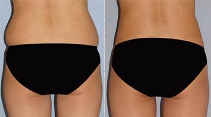 成都最受好評(píng)的整形醫(yī)院匯總，專業(yè)拉皮手術(shù)效果一流