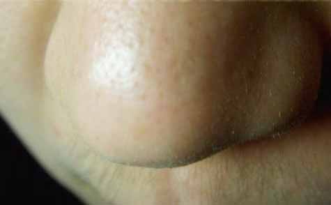 黃石后背吸脂醫(yī)生