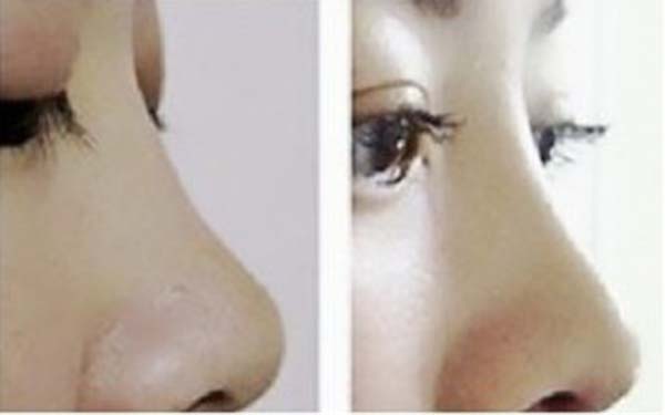 揭秘深圳三家知名整容機構(gòu)，助你尋找信賴的美容醫(yī)院