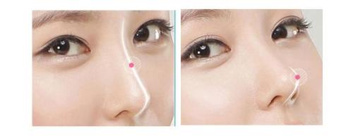 揭秘西安豐胸三甲醫(yī)院專家評(píng)選！西京、唐都脫穎而出，實(shí)力堪比五強(qiáng)！