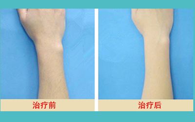 最新發(fā)布！匯總?cè)箩t(yī)院名單，解決牙齒問題待了整整一年