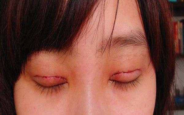 成都整形醫(yī)院修復(fù)隆鼻排行榜：前五強醫(yī)療機構(gòu)值得推薦！