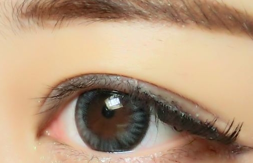 武漢眼紋去除手術醫(yī)生