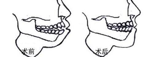 提供重慶哪家私立醫(yī)院割雙眼皮好？前五推薦_軍美領(lǐng)先，再揭秘