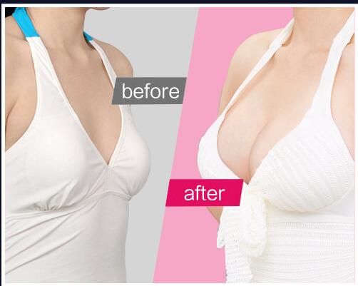 惠州市的頂尖整容整形醫(yī)院排行榜發(fā)布，時(shí)光演變伊麗莎白變得更加耀眼了！