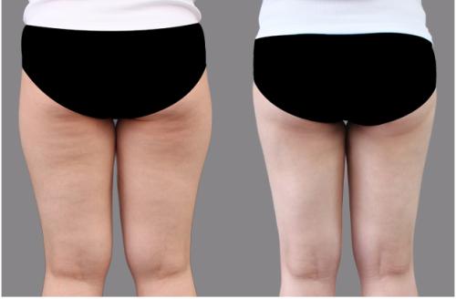 廣西整形醫(yī)院精選！當(dāng)紅top6醫(yī)院名單曝光，人氣首選聚焦簡介