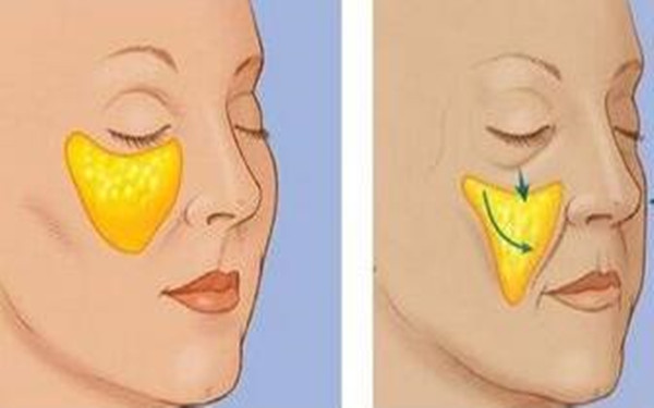 揭秘四川地區(qū)優(yōu)質(zhì)隆鼻醫(yī)院Top4，大多為公立醫(yī)療機構(gòu)！