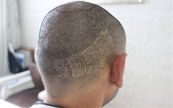 昆明市公立醫(yī)院整形科綜合比較：星耀、甘美、昆醫(yī)附屬等入圍前四！速查！