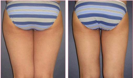 廊坊三河最佳整形醫(yī)院獨(dú)占前五！專家實(shí)力堪比頂尖！