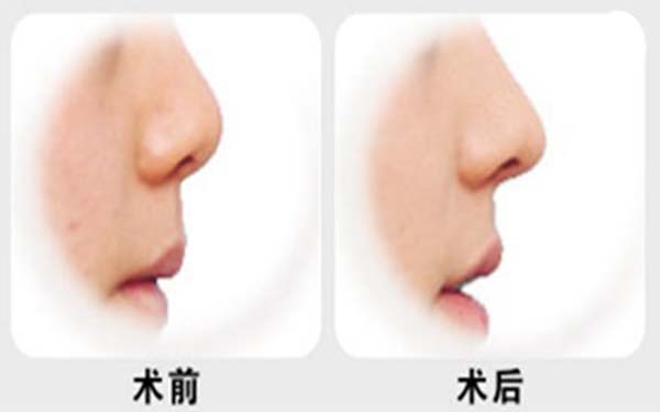 杭州專(zhuān)業(yè)整形美容醫(yī)院推薦榜單TOP7！熱門(mén)前三家療效不凡~