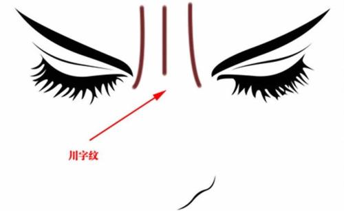 成都雙眼皮修復(fù)手術(shù)：五家性?xún)r(jià)比高、技術(shù)好的醫(yī)院推薦