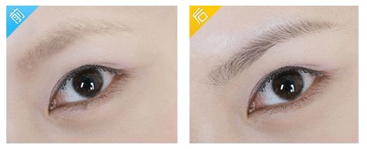 浙江哪個(gè)地方可以有效治療疤痕？?jī)?yōu)質(zhì)機(jī)構(gòu)入圍省內(nèi)六地8家！