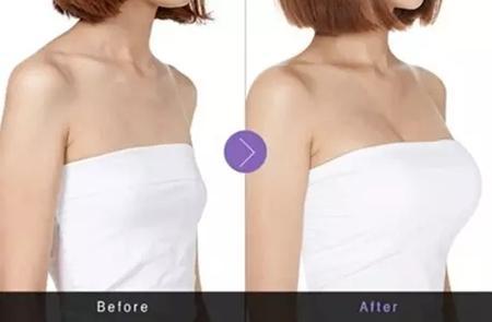 沈陽磨骨瘦臉五大頂級技術(shù)推薦，這幾家技術(shù)最受關(guān)注！