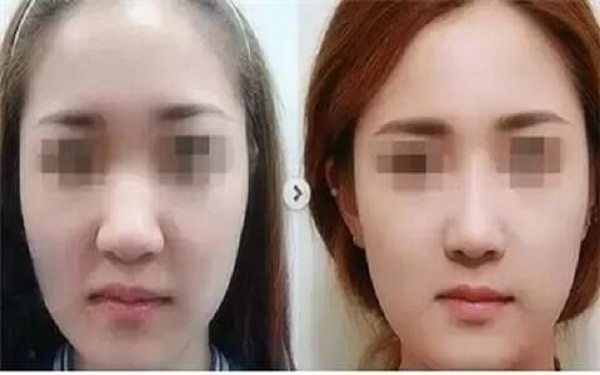 濰坊整形醫(yī)院推薦！這三家綜合評(píng)價(jià)絕對(duì)出眾