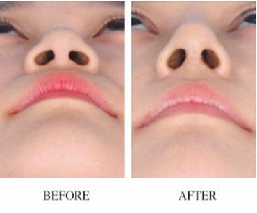 深圳熱瑪吉認證醫(yī)院推薦！選3家頂級機構(gòu)來看看