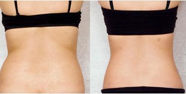 湖州湖人眼袋醫(yī)院TOP5，曙光與唯美齊爭魁！