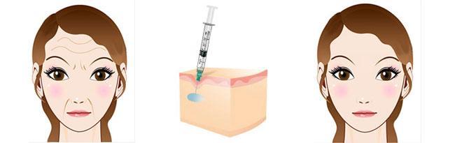 激光祛斑醫(yī)院推薦：曝光高效治療斑點(diǎn)的機(jī)構(gòu)合集，助你遠(yuǎn)離肌膚問題！