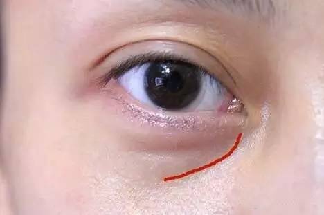 沈陽哪家醫(yī)院做雙眼皮好？推薦這幾家，讓你的雙眼美麗動人起來！