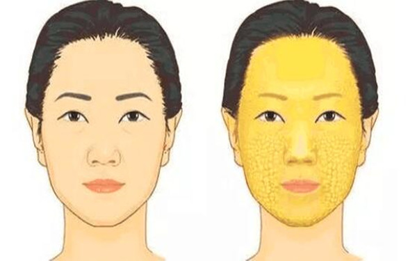 滄州治療疤痕的正規(guī)醫(yī)院推薦：專業(yè)科技祛疤，效果顯著！點擊了解！