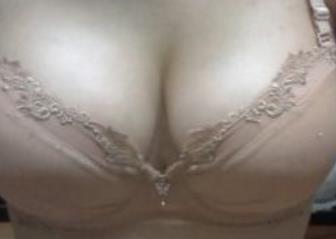 陜西紅外線儀器去雀斑醫(yī)生