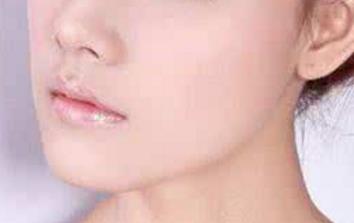 北京眼部細紋打除皺針醫(yī)生