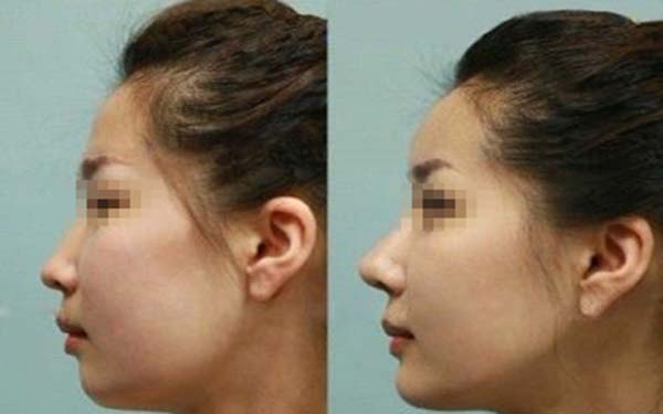 深圳頂級(jí)整容醫(yī)院排行榜發(fā)布！整形美容醫(yī)院報(bào)價(jià)明細(xì)表最新更新