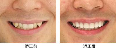 湖南綜合實力最強的整形醫(yī)院排行榜：這十家業(yè)內(nèi)知名醫(yī)院等你探尋！