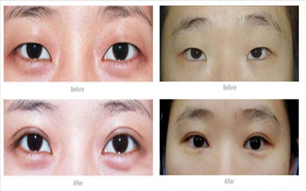 淮安有哪些口碑很好的整形醫(yī)院？前五排名來了！