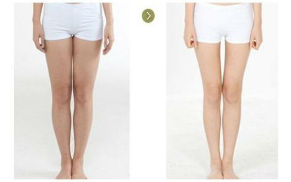 沈陽做拉皮提升除皺手術：4家值得考慮的醫(yī)院！