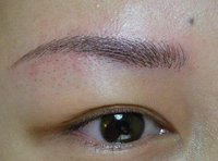 榆林市雙眼皮良心推薦！權(quán)威醫(yī)美機構(gòu)幫你找對方法