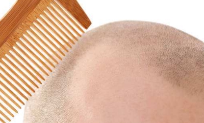 滄州市哪家醫(yī)院的隆鼻整形技術(shù)最實力？排行榜公布！