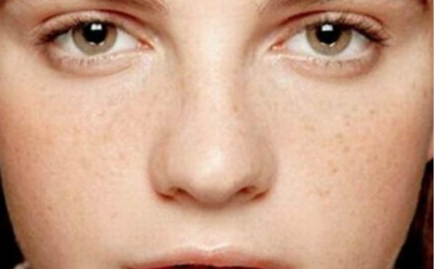 上海骨膜下隆鼻整形醫(yī)生