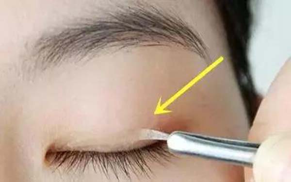 汕頭植發(fā)醫(yī)院排行榜前六：雍禾稱霸！曙光、華美也上榜！快來(lái)了解一下吧