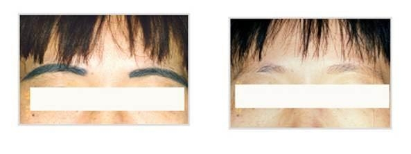 沈陽七家拉皮手術(shù)一流，用戶評價方法巧妙