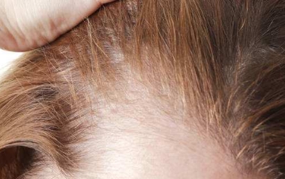 濟南哪家醫(yī)院做脂肪填充效果好？排名前五強報告來了！驚爆東方神秘揭曉