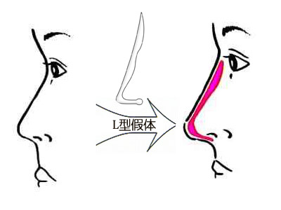 深圳最佳激光脫毛整形醫(yī)院推薦-公立醫(yī)院領(lǐng)跑市場！