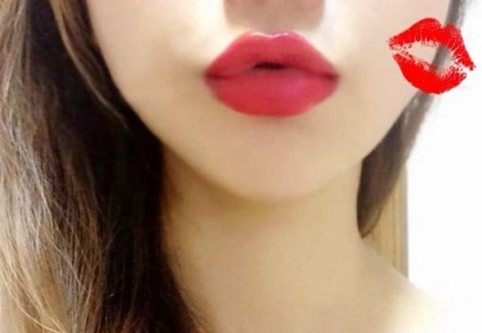 徐州改善眼角細紋醫(yī)生