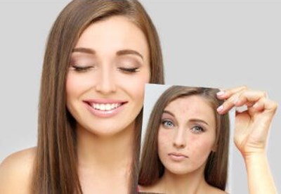 濰坊市雙眼皮整形怎樣選擇？人氣旺盛的三家醫(yī)院值得考慮！